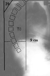 Advanced Biostructural Correction - Where Chiropractors Learn To Get ...