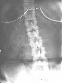 x-ray