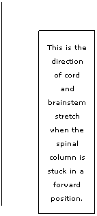 Line Callout 1: This is the direction of cord and brainstem stretch when the spinal column is stuck in a  forward position.
